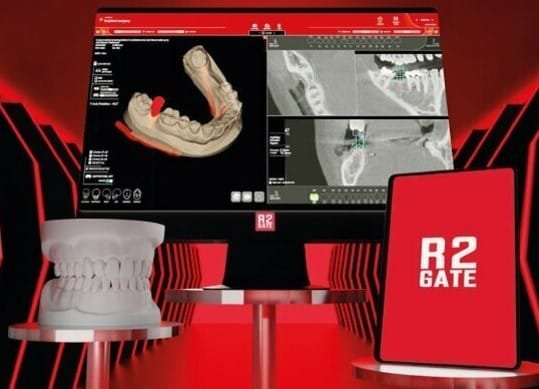 Home 25 Exocad DentalCAD